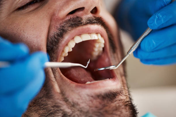 Best Walk-In Emergency Dentist in Monmouth, OR